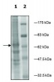 Ceramide Kinase FLAG tag active human