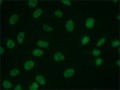 Anti-CHD1 (C-terminal) antibody from rabbit