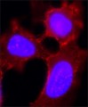 Anti-Desmoglein 2 (DSG2) antibody, Mouse monoclonal