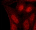 Monoclonal Anti-Myb antibody from mouse