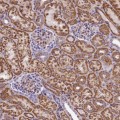 Anti-DNAJB9 antibody produced in rabbit