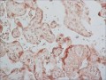 Anti-Breast Cancer Resistance Protein antibody produced in rabbit